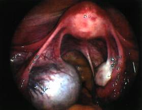 http://www.kunpendelek.ru/content/apteka/ovarian-cysts/7.jpg