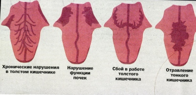 http://www.kunpendelek.ru/content/diagnostic/lang-diagnostic/12.jpg