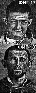 Знаки вырождения Знаки вырождения