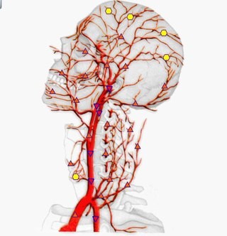 ����������-���������� �������� ��������-21 