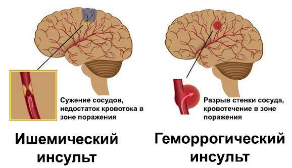 ������� � ��� �������������