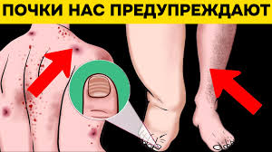 ������ �������� ����������� �����