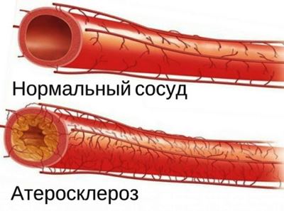 ������������ �������������