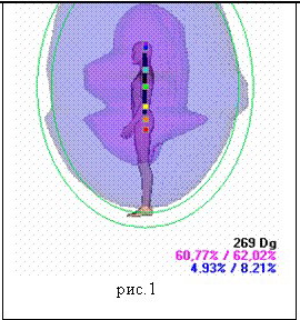 �������:���.1    