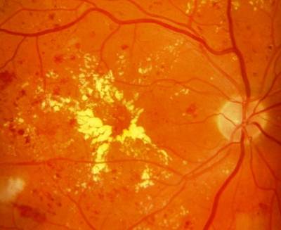 ������� �������