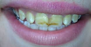 ��� ������ ��� ����, ������ � ������������ 