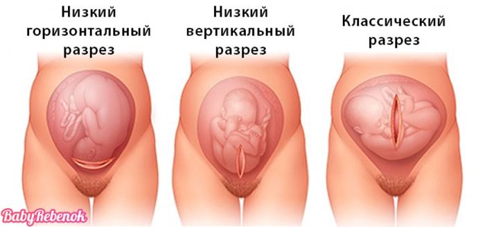 �������� �������. �������������