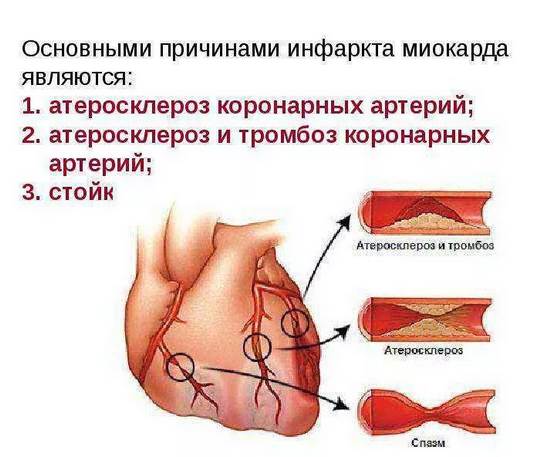 �����, �����, �������...