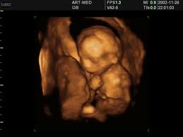 � ������� ��� �� ����