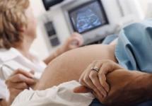 � ������� ��� �� ����