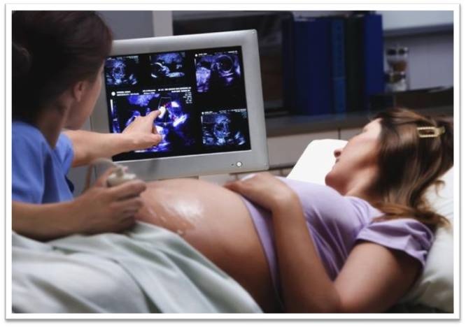 � ������� ��� �� ����